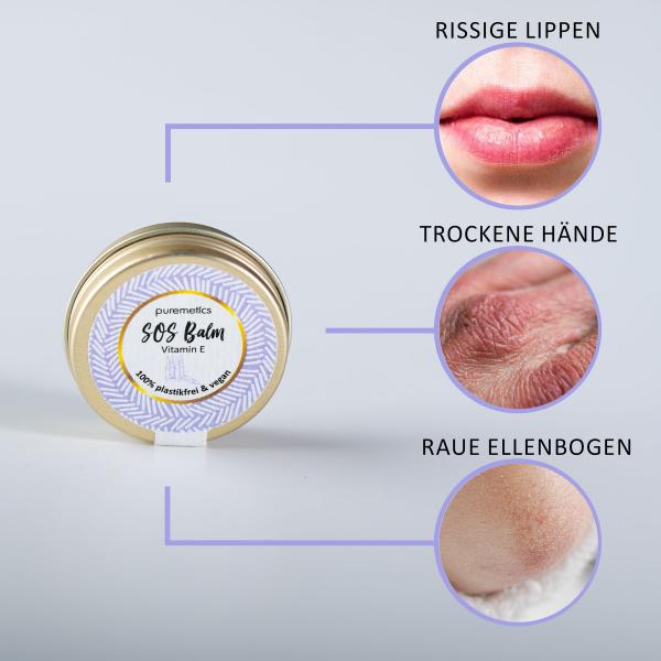 SOS Balm